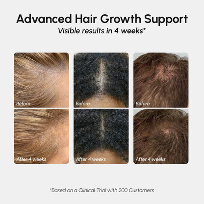 4-in-1 Hair Growth Spray